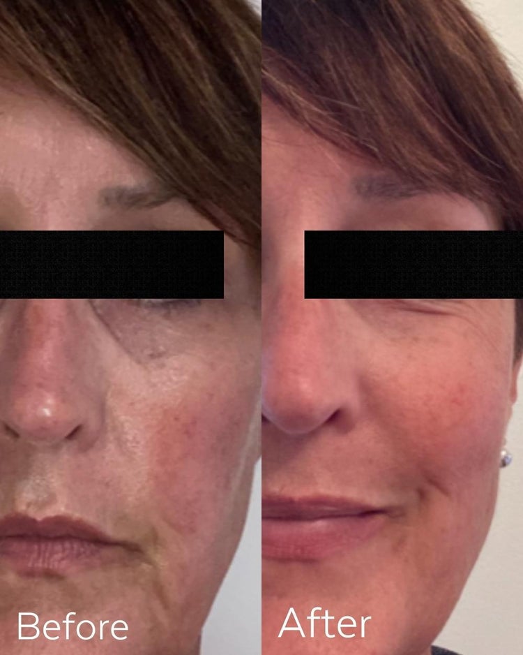 THREE SHIPS - Boost 49% Rosehip Oil Serum