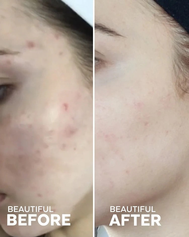 THREE SHIPS - Dew Drops Mushroom Hyaluronic Acid + Vitamin C Serum